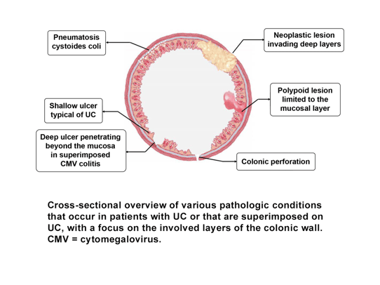 Cross-Sectional-Illustration