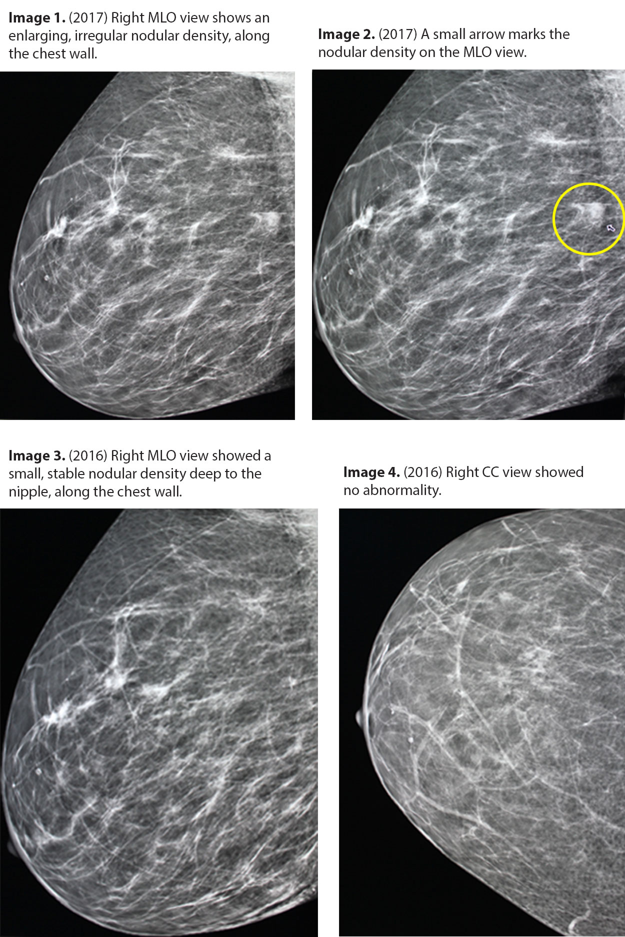 A Radiologist s Perspective on the Importance of Marking Moles in