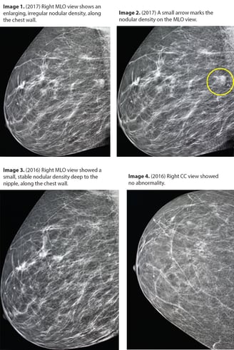 A Radiologist's Perspective on the Importance of Marking Moles in ...