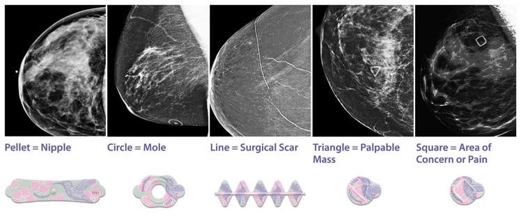 Beekley Skin Marking System for Mammography