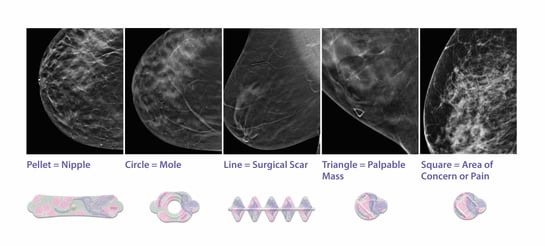 BSMS-3D-Tomosynthesis-Compiled-Image