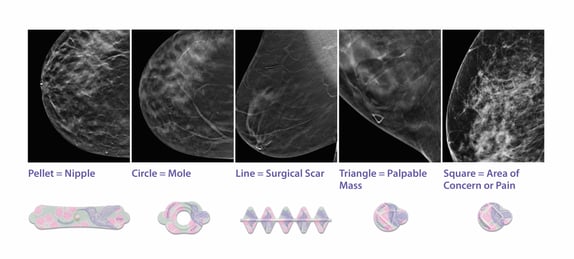 BSMS-3D-Tomosynthesis-Compiled-Image