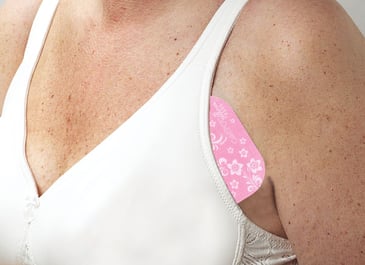 Minimizing Bleeding, Hematoma in the Breast Biopsy Patient