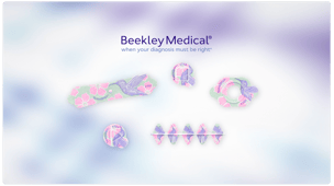 Clear and Accurate Best Practices in Mammography with the Beekley Skin Marking System