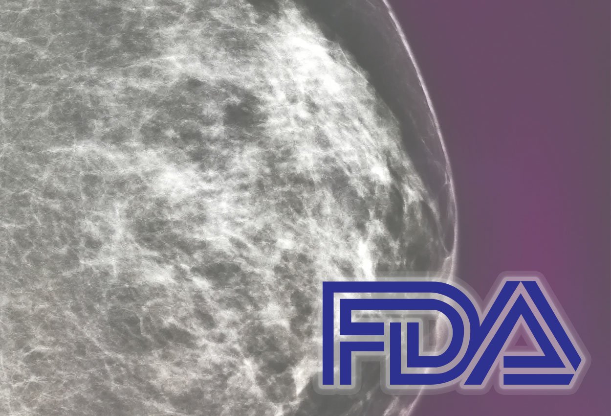 FDA-Breast-Density-Notification_CvrImg