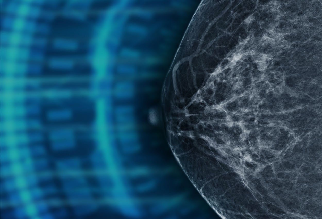 breast x-ray with abstract background