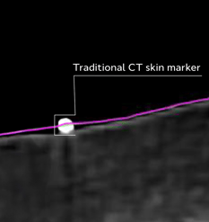 ctskin-marker