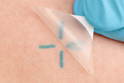 InkRight being applied to the skin