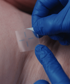 An InkRight Semi Permanent tattoo being applied to the skin