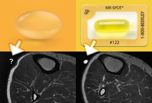 inventing-new-mri-marker-cvr