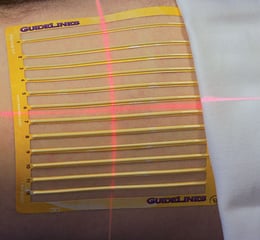 GuideLines in use on a patient.