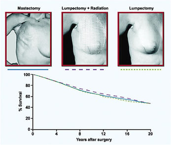 Less Invasive Surgery Pictorials & Graph
