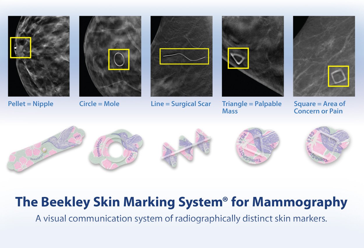 The Beekley Skin Marking System for Mammography
