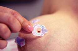 mole marker being placed on breast