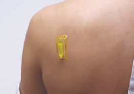 mr-spot-on-patient-shoulder