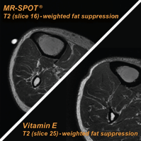 mr-spot-vs-vitamin-e-comparison