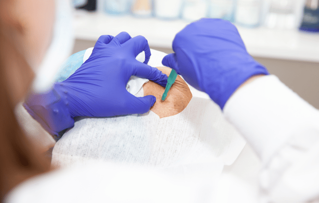 Doctor performing needle biopsy on a patient.