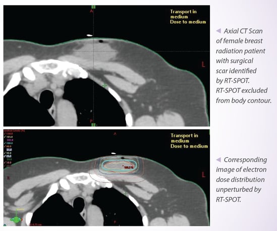 Examples of RT-SPOT working on a scan