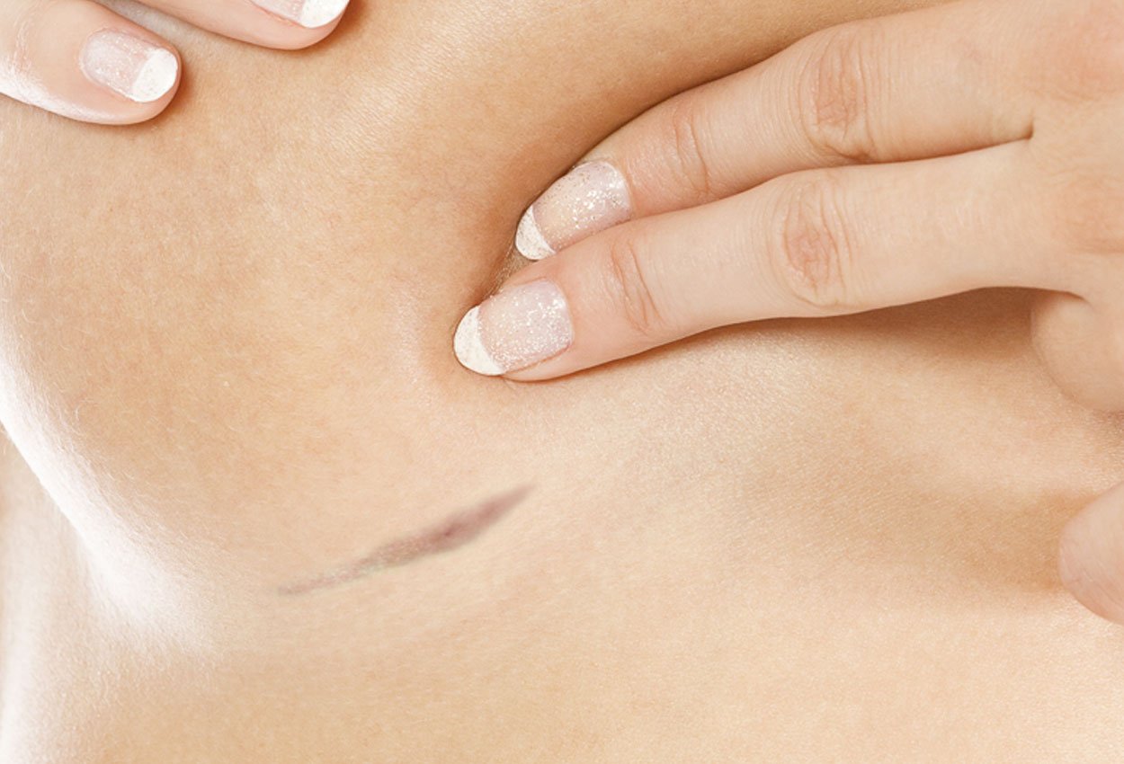 Breast skin. Breast Skin paddeit.