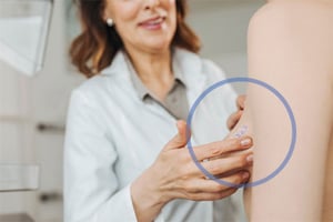 TomoSPOT scar marker applied to breast
