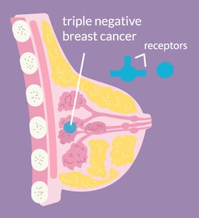 triple negative breast cancer diagram