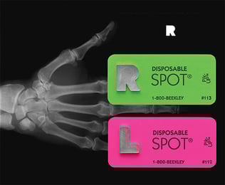 R+L-X-ray
