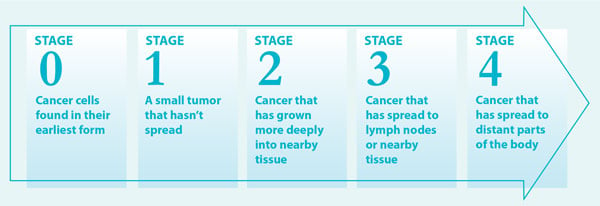cancer-stages-chart