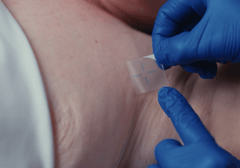 inkright-being-put-on patient