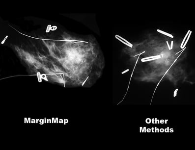 MarginMap scans compared with other methods.