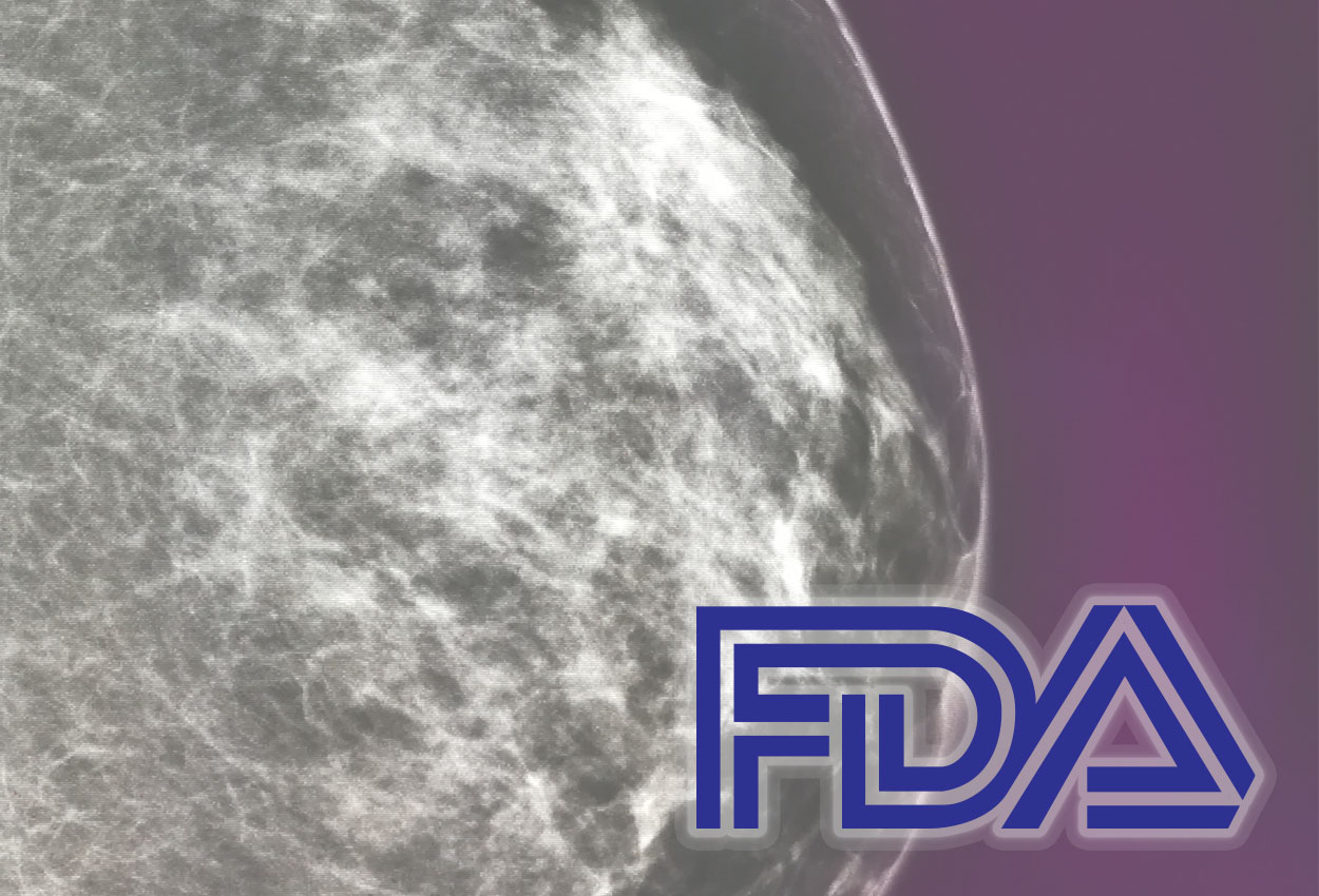 FDA Breast Density Notification Legislation Deadline Quickly Approaching