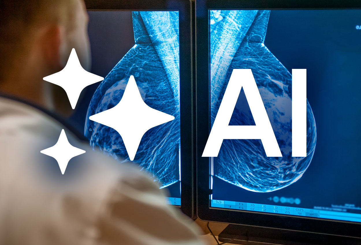 Best Practices for AI in Mammography