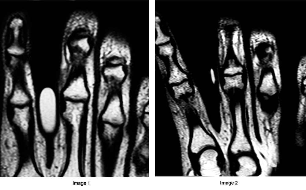 Imaging Markers - Medical Imaging