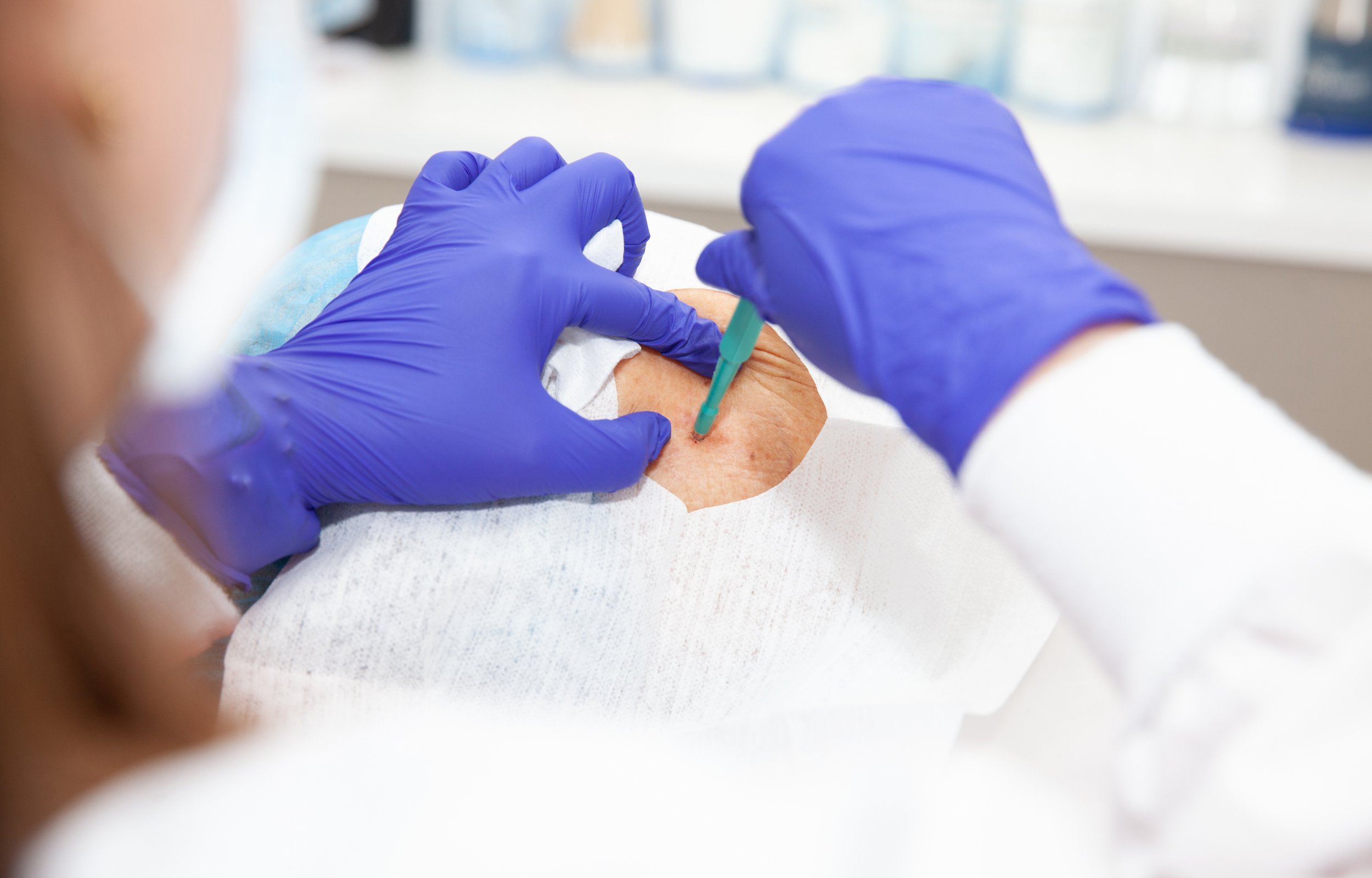 When Precision Matters: Enhancing Confidence in CT-Guided Needle Biopsies