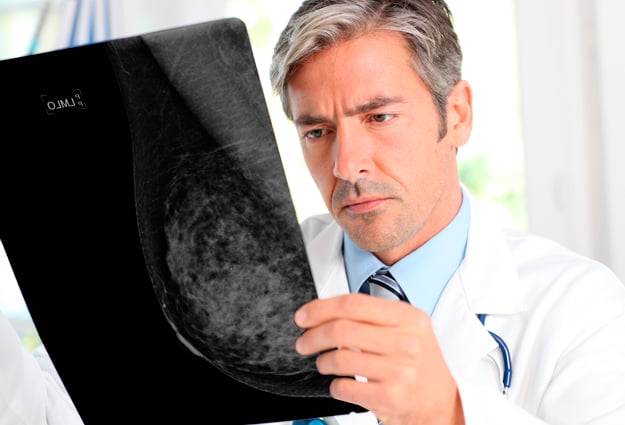 Why is Radiology Malpractice so High When it Comes to Your Mammogram?