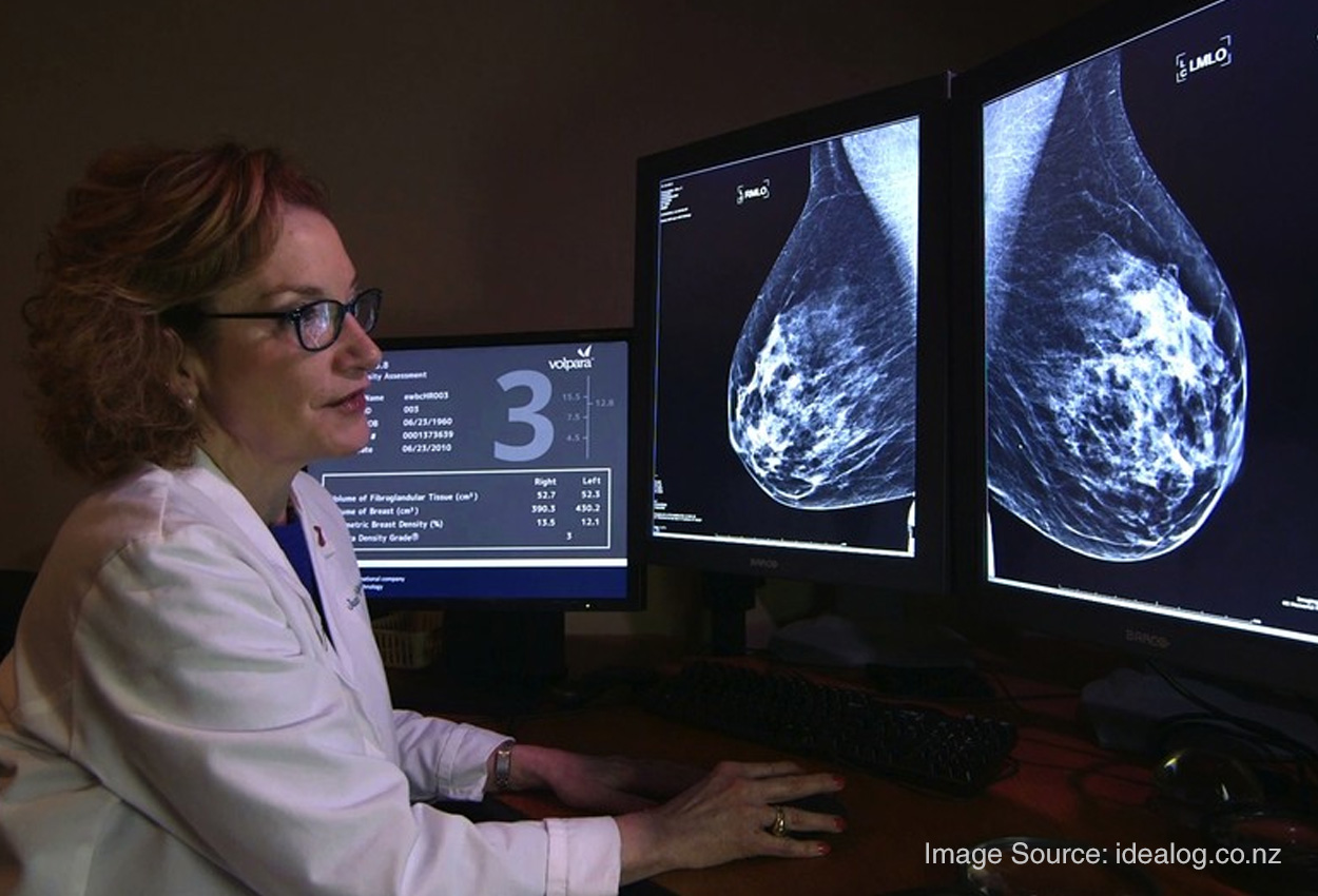 A Radiologist's Perspective on the Importance of Marking Moles in  Mammography