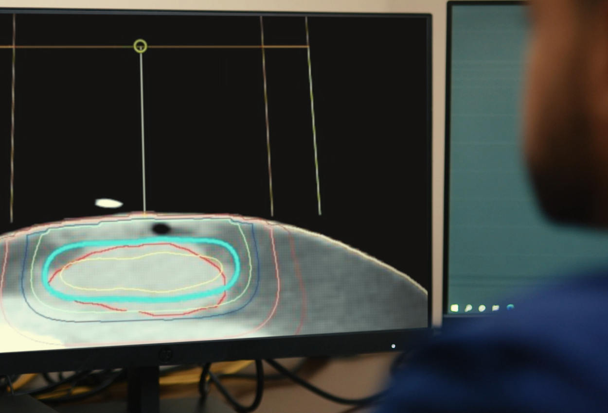 Standardizing CT Simulation to Protect Dose Calculation Accuracy