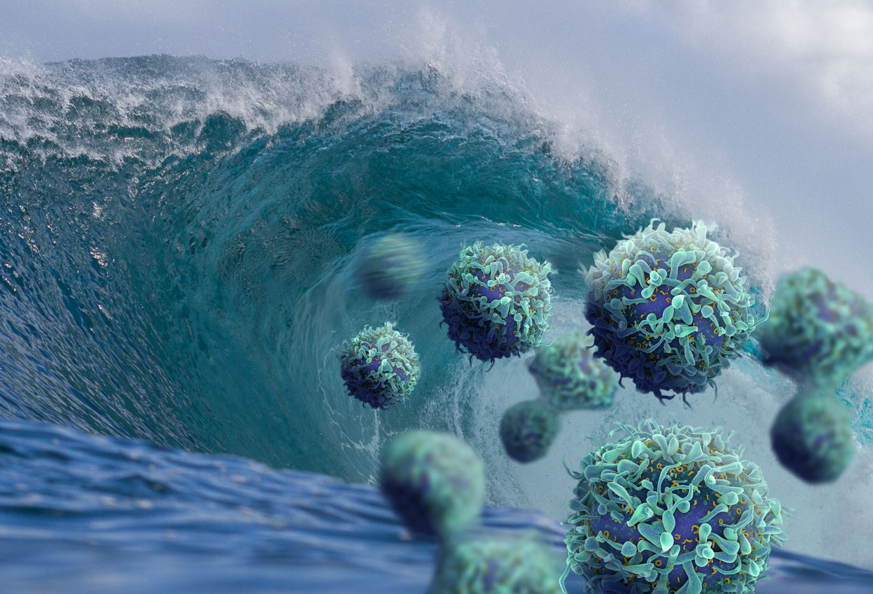 A Tsunami of Cancer: Fallout from Pandemic-Delayed Screening and Treatment