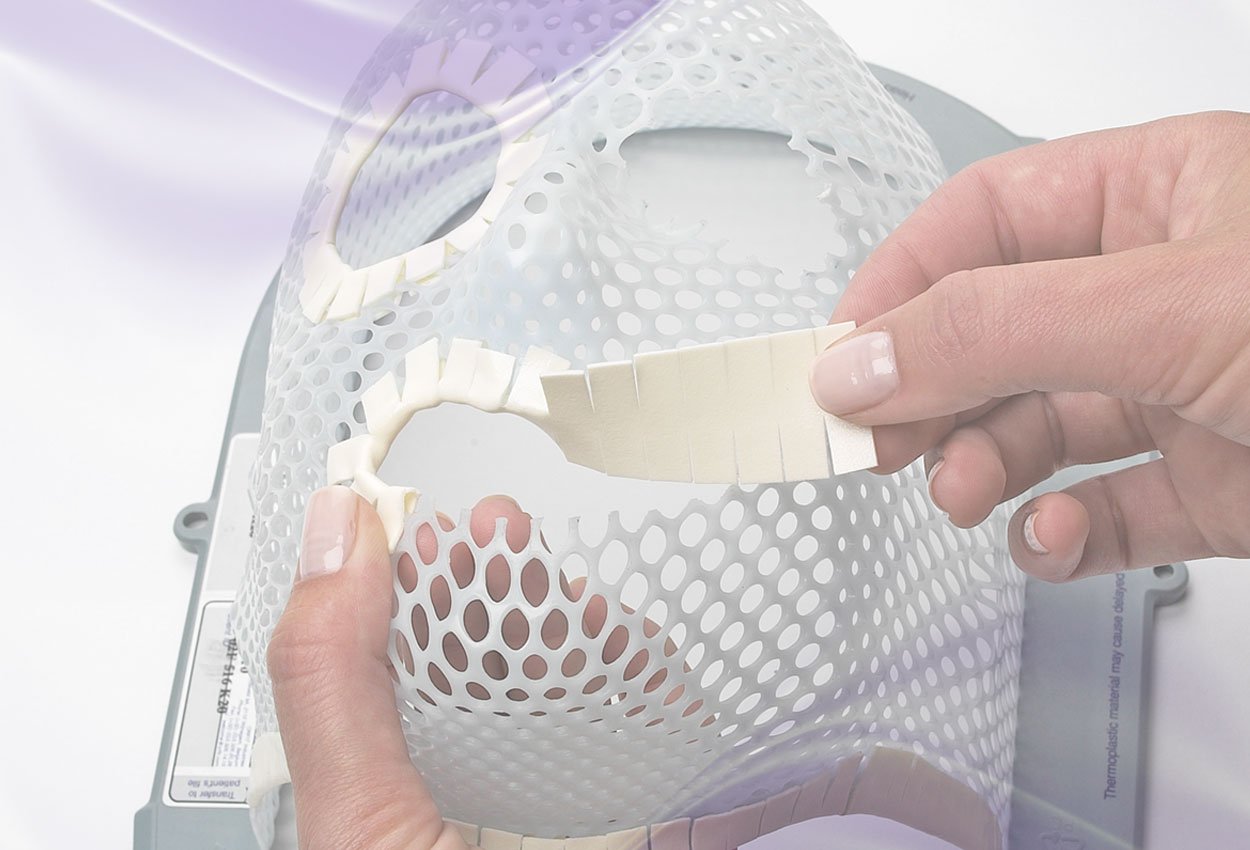 Improving Thermoplastic Mask Tolerance with TenderTouch